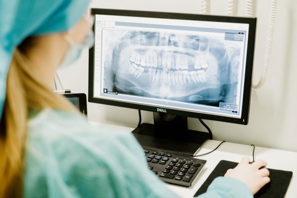 Ardent Implant centar - 3D snimanje zuba